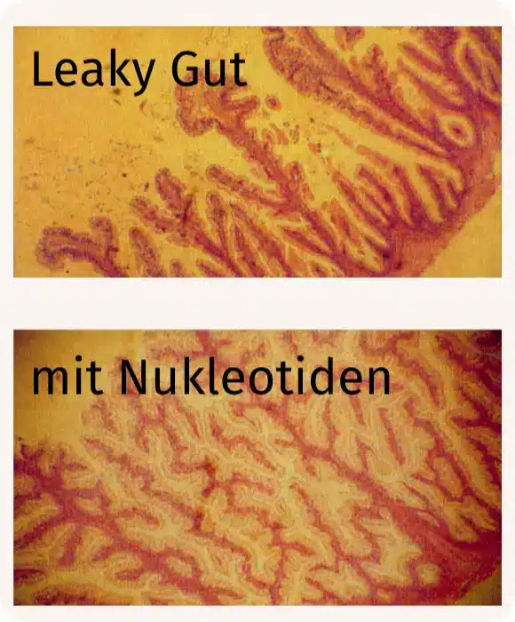 Leaky Gut vs Nukleotiden